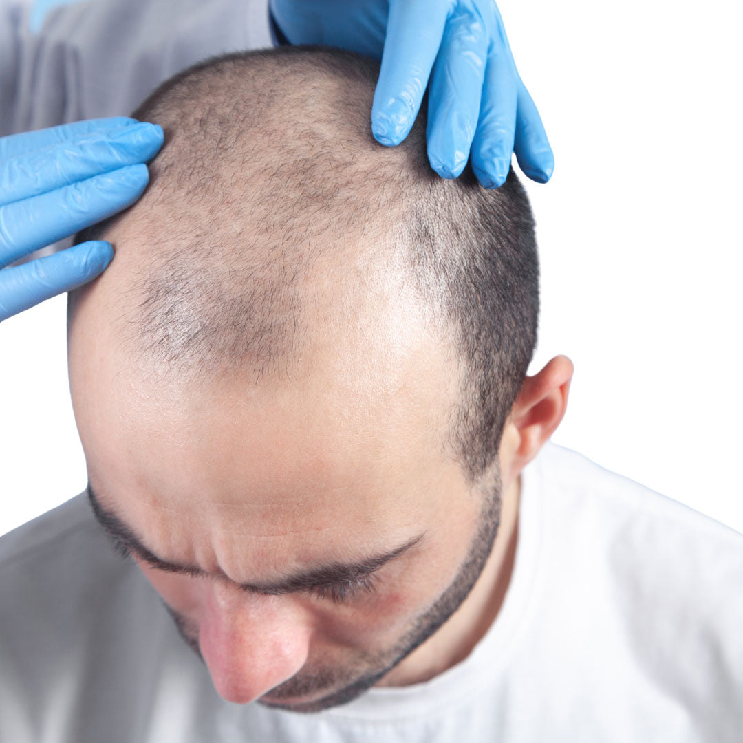 Red Light Therapy for Hair Growth