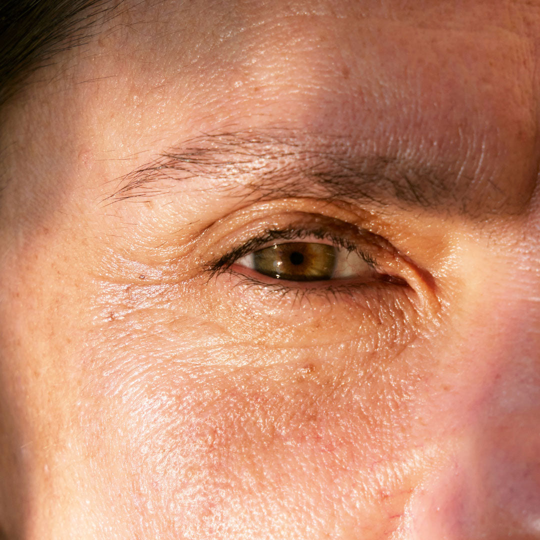 Reducing Fine Lines and Wrinkles with Red Light