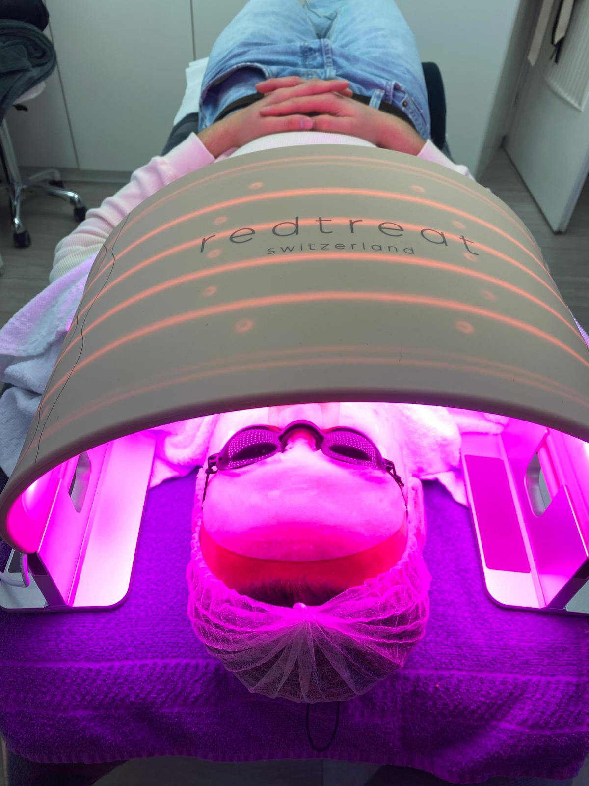 redtreat SolisHead LED Light Therapy Arc for hair growth, skin regeneration, and inflammation relief